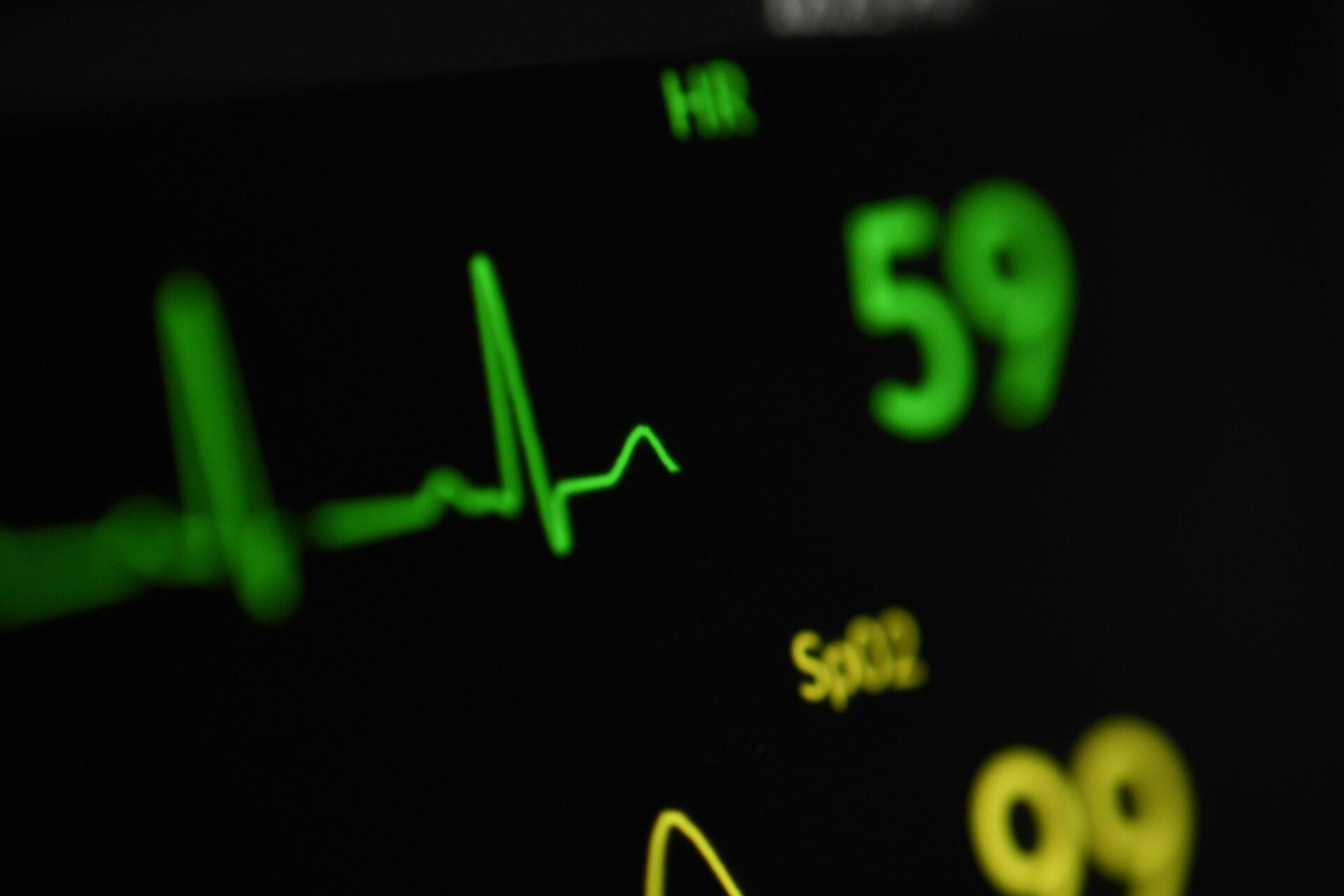 ECG/EKG Machines