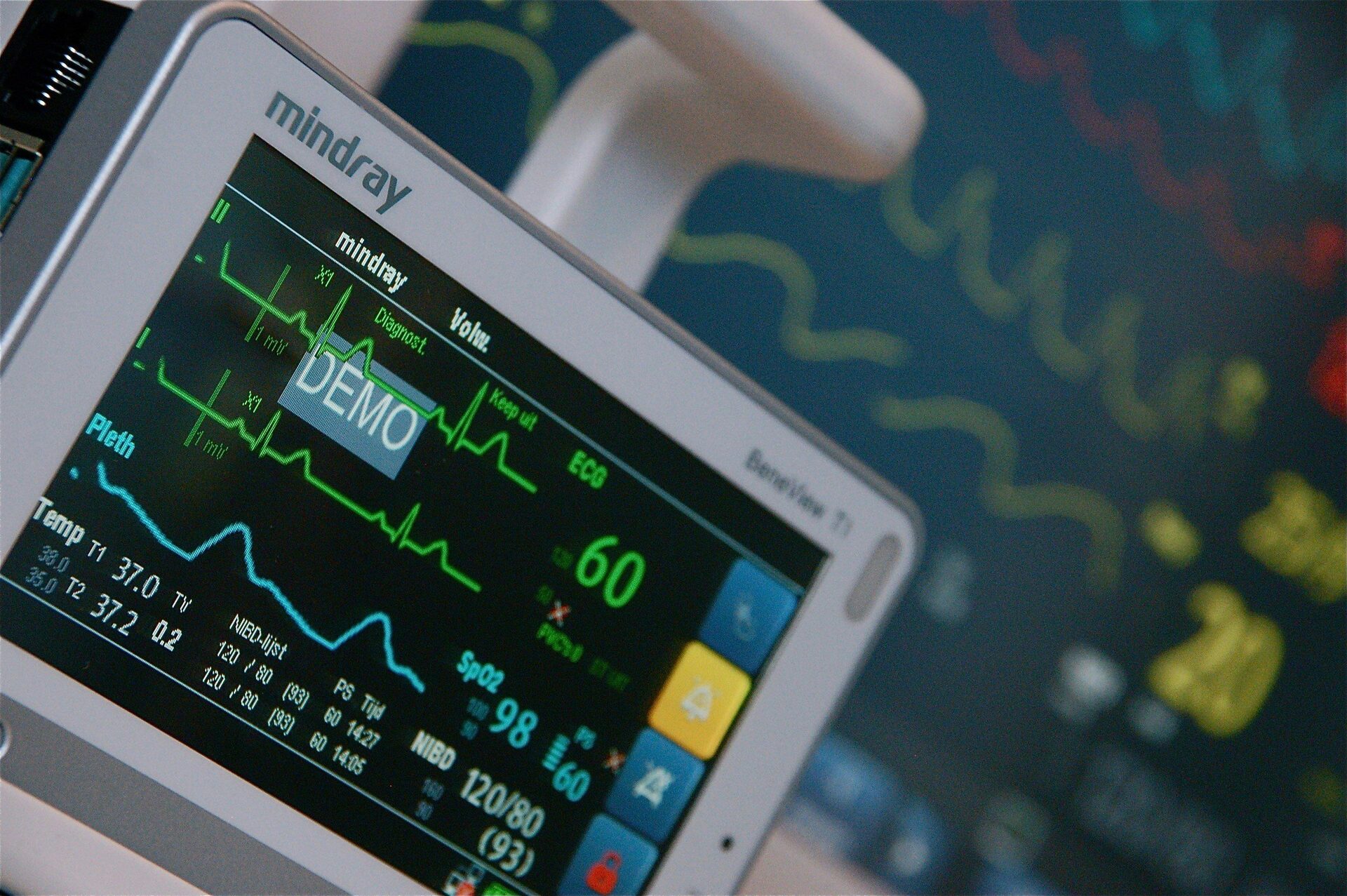 Patient Monitors