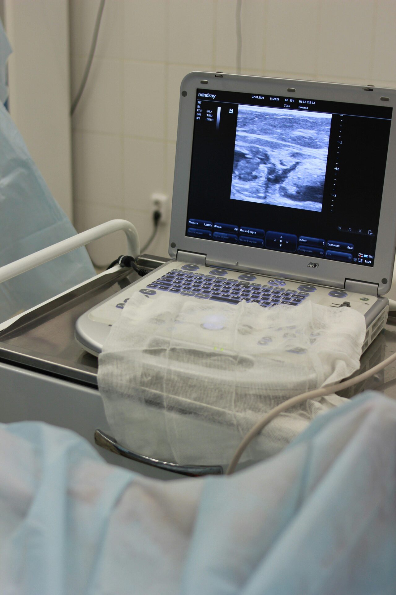 Diagnostic Ultrasound Systems