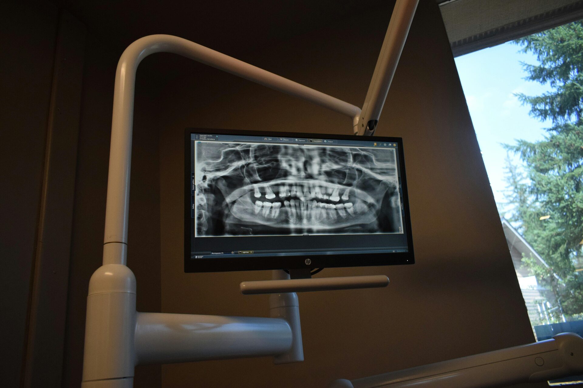 X-Ray View Box / Illuminators
