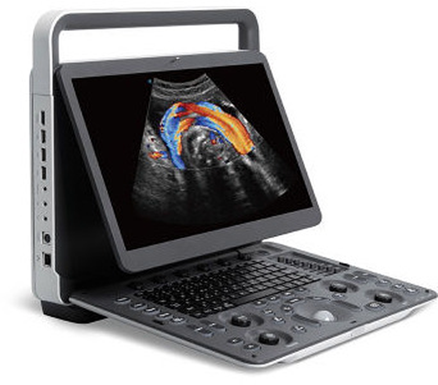 SonoScape E2 Portable Colour Doppler Ultrasound System