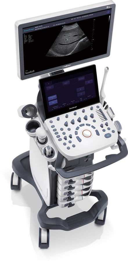 SonoScape P15 Trolley Colour Doppler Ultrasound System