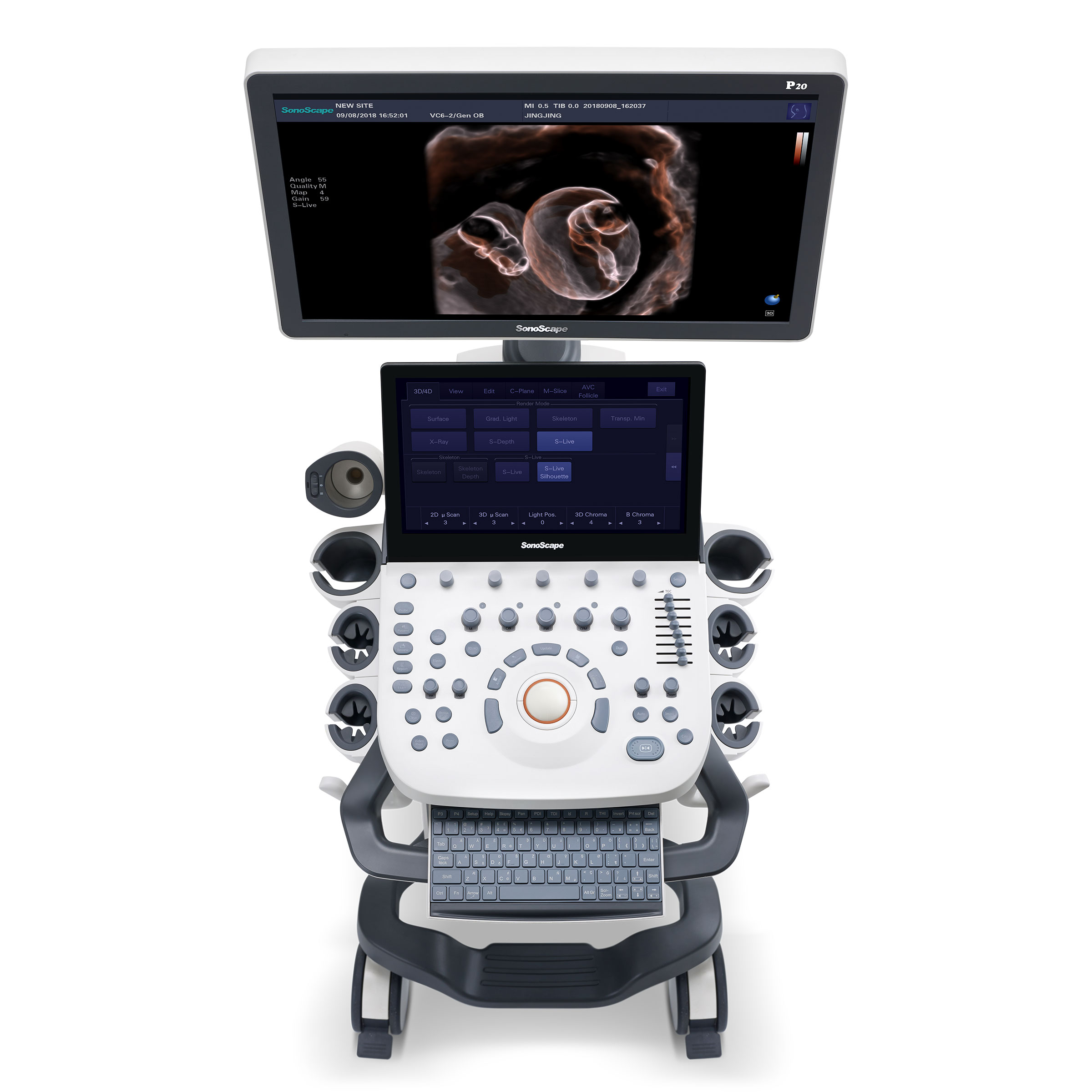 SonoScape P20 Trolley Colour Doppler Ultrasound System