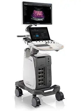 SonoScape P60 Trolley Colour Doppler Ultrasound System