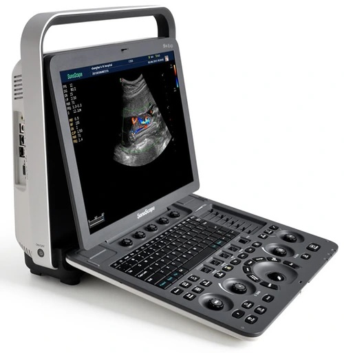 SonoScape S8 Exp Portable Colour Doppler Ultrasound System