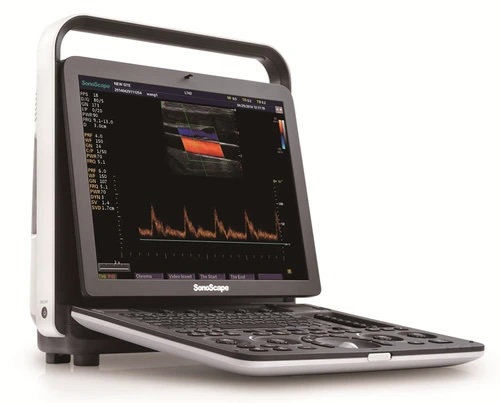 SonoScape S9 Portable Colour Doppler Ultrasound System